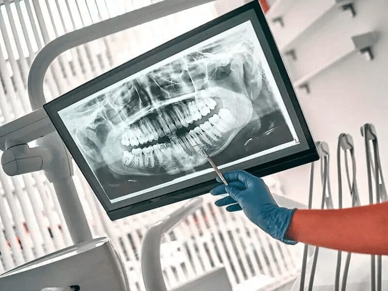 digital-dental-imaging-and-xrays